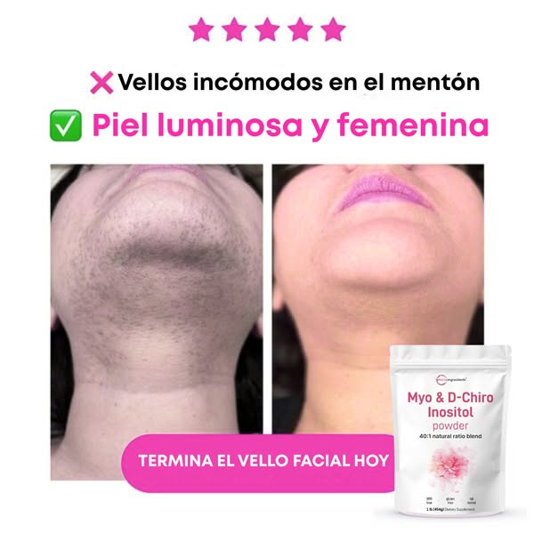 Myo & D-Chiro Inositol™: Equilibrio Hormonal Femenino